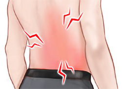 Burning, sharp or aching pain in the area where the shingles rash appeared