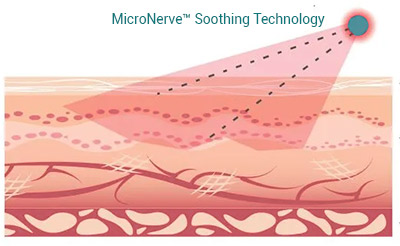 MicroNerve Soothing Technology